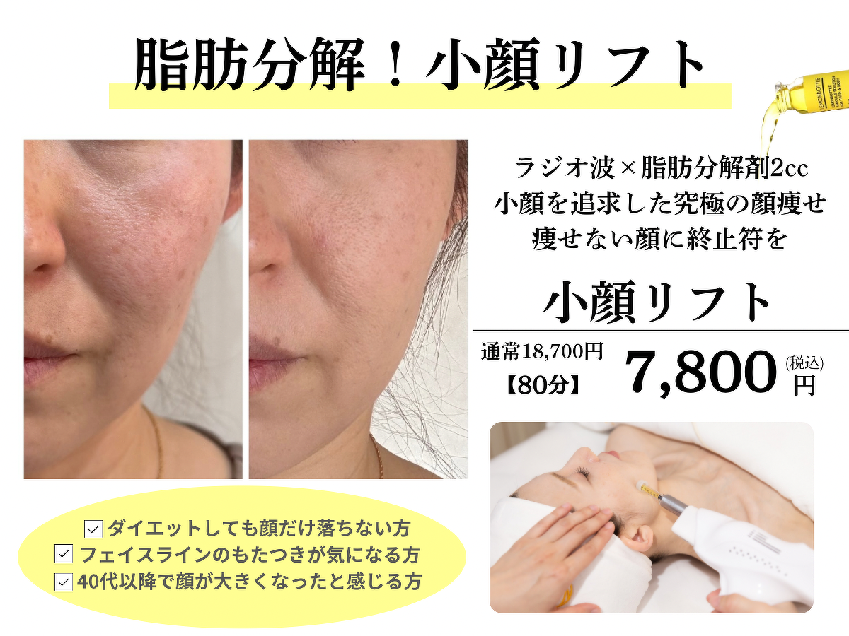 脂肪分解小顔リフト